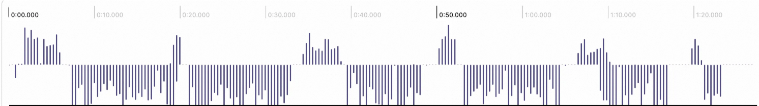 Case 1 Audio Waveform